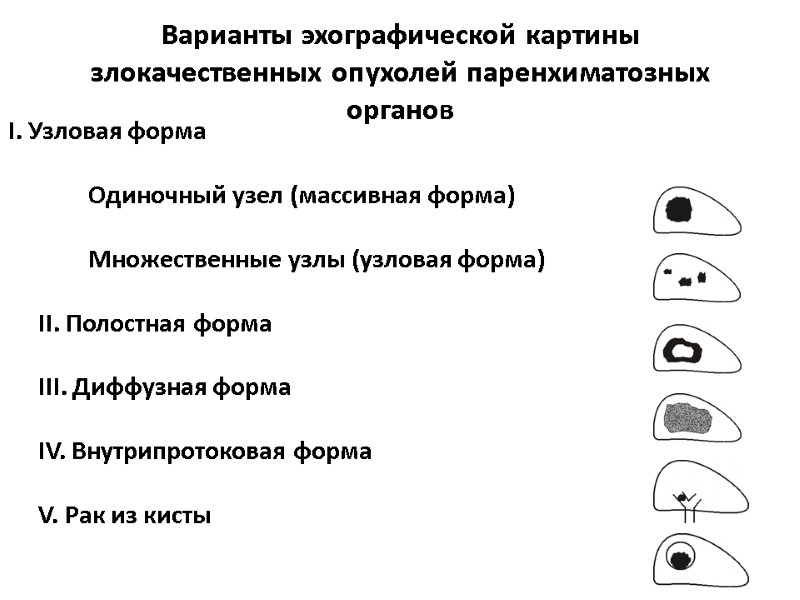 Варианты эхографической картины злокачественных опухолей паренхиматозных органов  I. Узловая форма   Одиночный